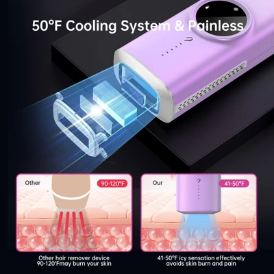 Hair Removal For Men And Women, Painless Hair Removal Device, Safe And Long-lasting, Reduces Body And Facial Hair Growth, For Home 8 Hair Removal For Men And Women, Painless Hair Removal Device, Safe And Long-lasting, Reduces Body And Facial Hair Growth, For Home - Image 6